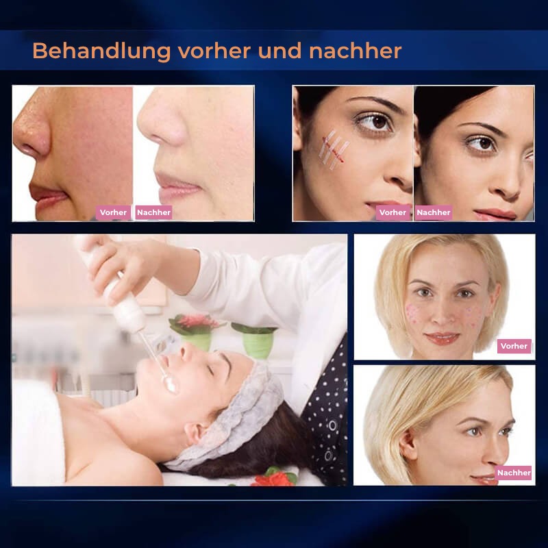 aparat-cosmetic-electroderm-edman-tratamente-infrumusetare-biostimulare-faciala-lifting-profesional-4-capete-glow-gallery